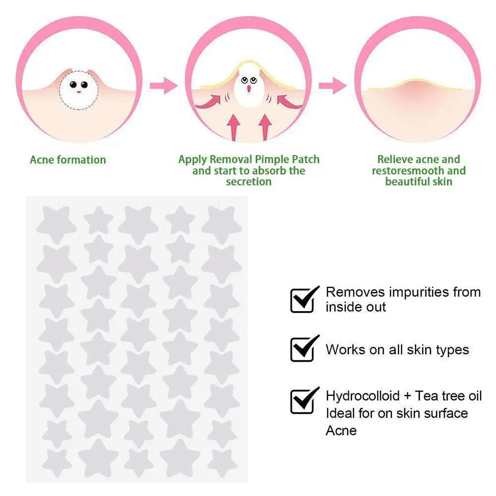 Star Acne Patches – Yellow Star-Shaped Hydrocolloid Pimple Dots, 40 Count, All Skin Types