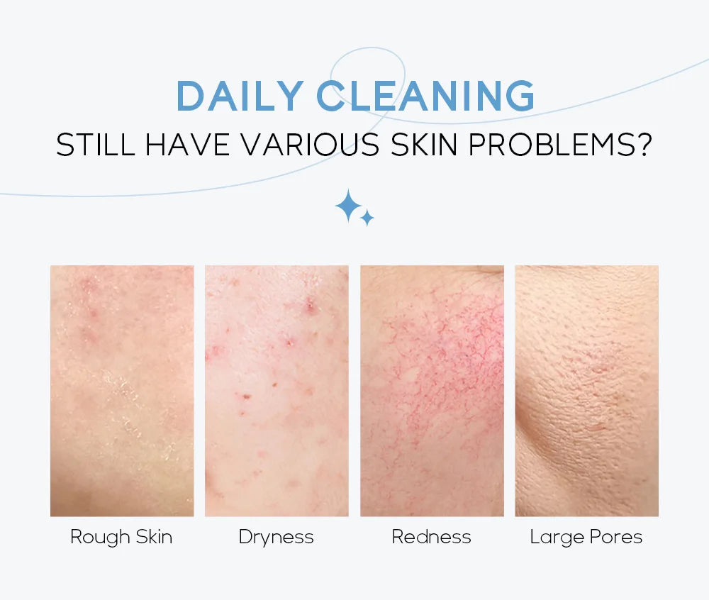 Korean Milk Facial Cleanser – Deep Moisture, Oil Control & Glowing Skin | Hyaluronic Acid, PH-Balanced for Dry/Oily Skin 80g