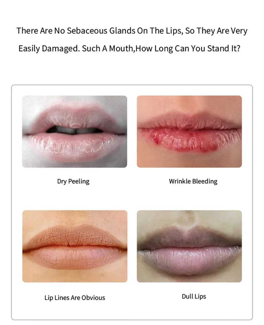 Vitamin C Moisturizing Skincare Lip Mask Reducing Lip Wrinkles Repair Skin Lip Patches Face Care Masks Recreate Sexy Lips